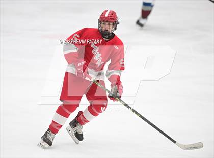 Thumbnail 3 in Conard @ BBD [Brookfield/Bethel/Danbury] photogallery.