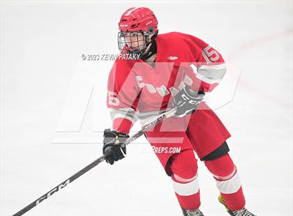 Thumbnail 3 in Conard @ BBD [Brookfield/Bethel/Danbury] photogallery.