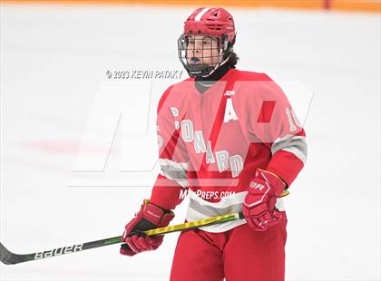 Thumbnail 3 in Conard @ BBD [Brookfield/Bethel/Danbury] photogallery.