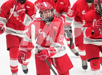Thumbnail 2 in Conard @ BBD [Brookfield/Bethel/Danbury] photogallery.