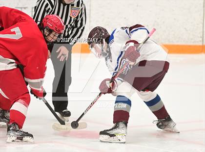 Thumbnail 3 in Conard @ BBD [Brookfield/Bethel/Danbury] photogallery.