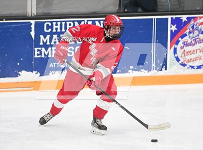 Thumbnail 1 in Conard @ BBD [Brookfield/Bethel/Danbury] photogallery.
