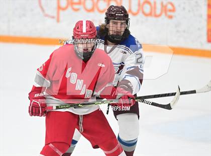 Thumbnail 1 in Conard @ BBD [Brookfield/Bethel/Danbury] photogallery.