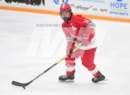 Thumbnail 1 in Conard @ BBD [Brookfield/Bethel/Danbury] photogallery.