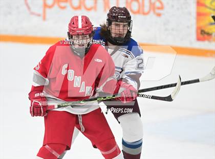 Thumbnail 2 in Conard @ BBD [Brookfield/Bethel/Danbury] photogallery.