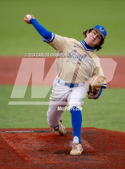 Thumbnail 2 in Tivy vs. Hendrickson (Liberty Hill Tournament) photogallery.