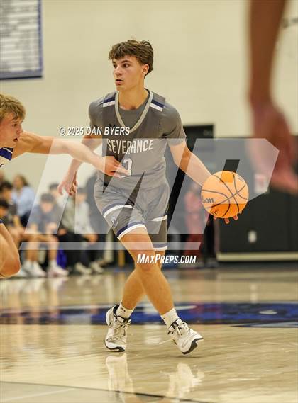 Thumbnail 1 in Severance @ Resurrection Christian photogallery.