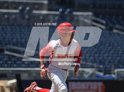 Thumbnail 1 in Hoover vs. Kearny  photogallery.