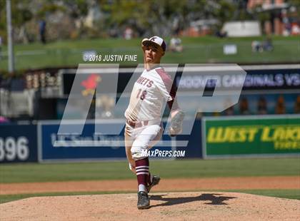 Thumbnail 2 in Hoover vs. Kearny  photogallery.