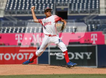 Thumbnail 2 in Hoover vs. Kearny  photogallery.