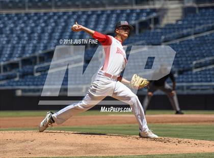 Thumbnail 2 in Hoover vs. Kearny  photogallery.
