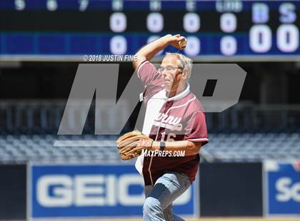 Thumbnail 1 in Hoover vs. Kearny  photogallery.