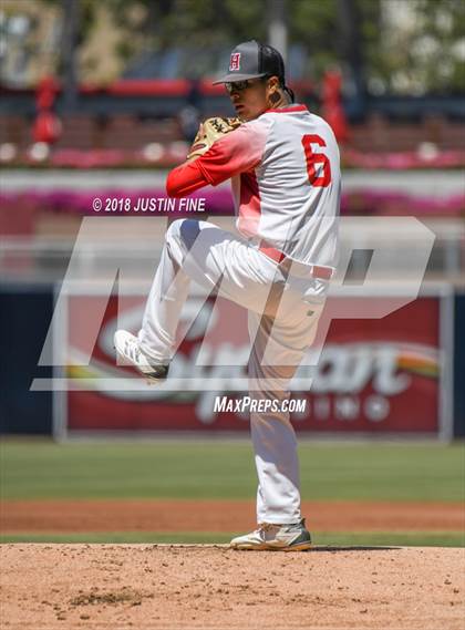 Thumbnail 3 in Hoover vs. Kearny  photogallery.