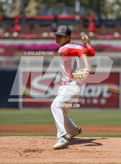Thumbnail 2 in Hoover vs. Kearny  photogallery.
