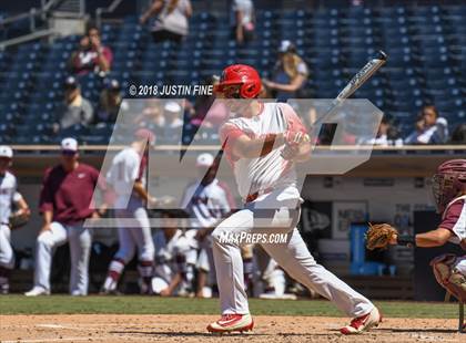 Thumbnail 3 in Hoover vs. Kearny  photogallery.