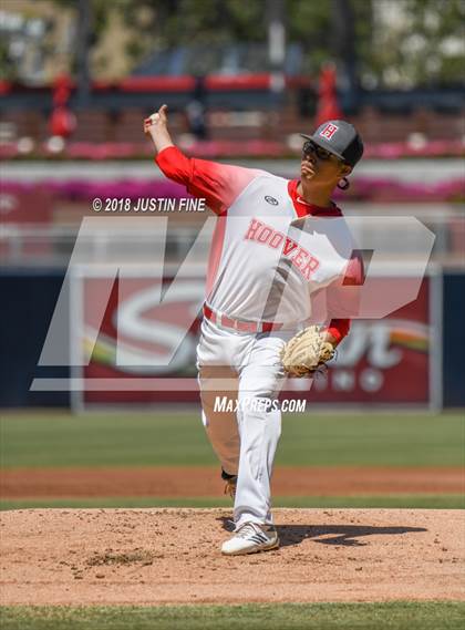 Thumbnail 1 in Hoover vs. Kearny  photogallery.