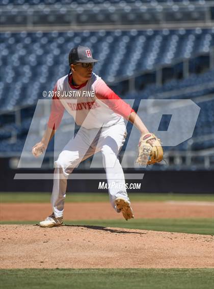 Thumbnail 2 in Hoover vs. Kearny  photogallery.