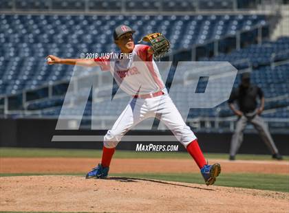 Thumbnail 2 in Hoover vs. Kearny  photogallery.