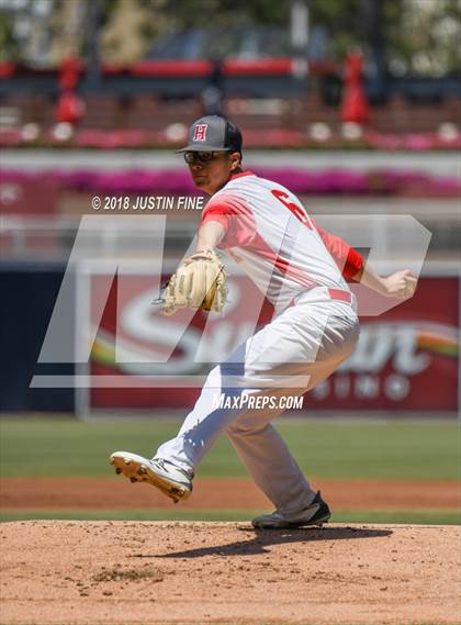 Thumbnail 1 in Hoover vs. Kearny  photogallery.
