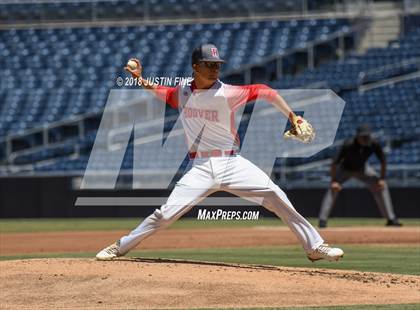 Thumbnail 1 in Hoover vs. Kearny  photogallery.