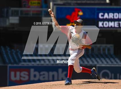 Thumbnail 1 in Hoover vs. Kearny  photogallery.