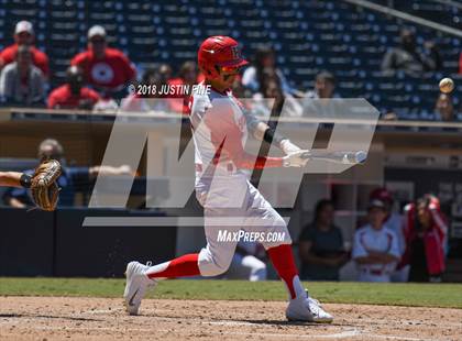 Thumbnail 2 in Hoover vs. Kearny  photogallery.