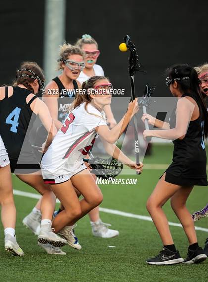 Thumbnail 2 in Mercy @ DuPont Manual photogallery.