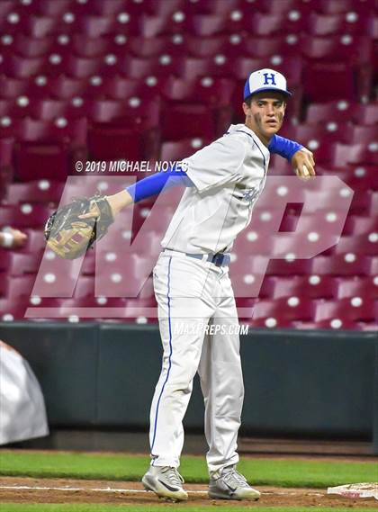 Thumbnail 1 in Beechwood vs. Highlands (Futures Showcase) photogallery.