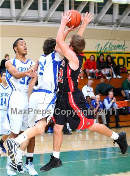 Thumbnail 2 in Culver City vs. Palos Verdes (Mira Costa Pacific Shores) photogallery.