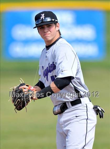 Thumbnail 2 in Anna vs Sanger (Gunter/Prosper Classic) photogallery.