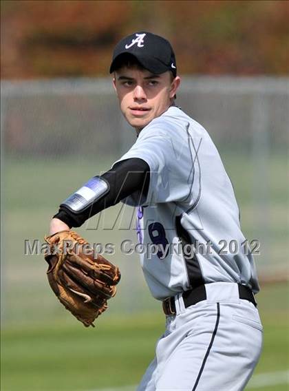 Thumbnail 1 in Anna vs Sanger (Gunter/Prosper Classic) photogallery.
