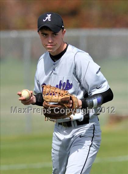 Thumbnail 1 in Anna vs Sanger (Gunter/Prosper Classic) photogallery.