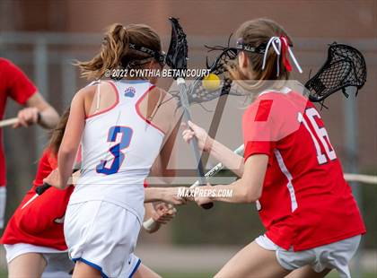 Thumbnail 3 in Cherry Creek vs Denver East photogallery.