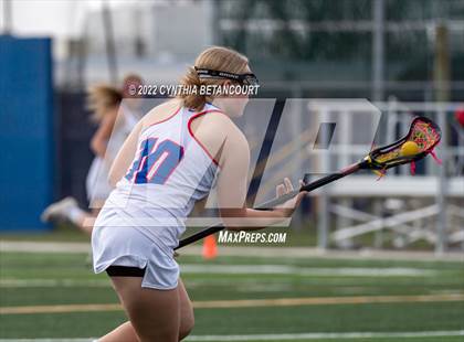 Thumbnail 1 in Cherry Creek vs Denver East photogallery.