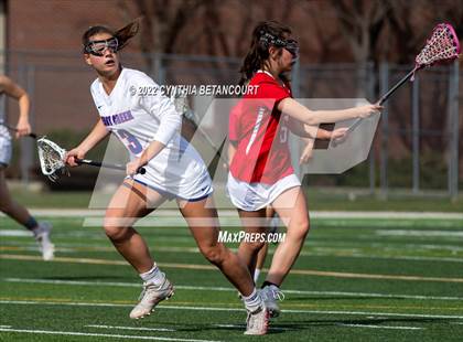 Thumbnail 1 in Cherry Creek vs Denver East photogallery.