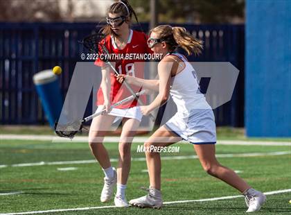 Thumbnail 3 in Cherry Creek vs Denver East photogallery.