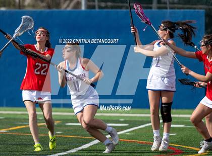 Thumbnail 1 in Cherry Creek vs Denver East photogallery.