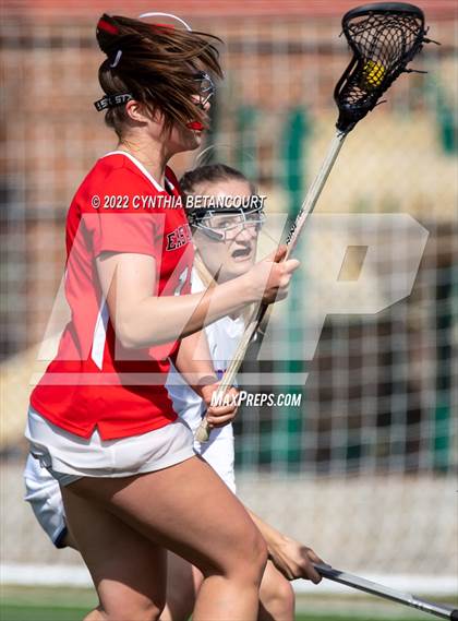 Thumbnail 1 in Cherry Creek vs Denver East photogallery.