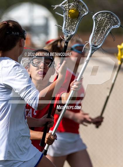 Thumbnail 1 in Cherry Creek vs Denver East photogallery.