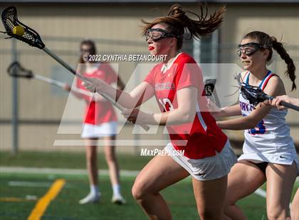 Thumbnail 1 in Cherry Creek vs Denver East photogallery.