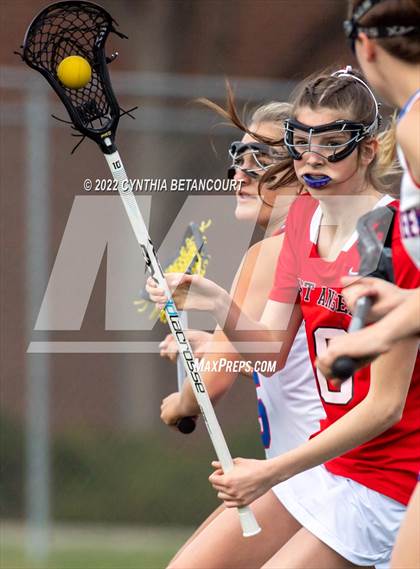 Thumbnail 1 in Cherry Creek vs Denver East photogallery.