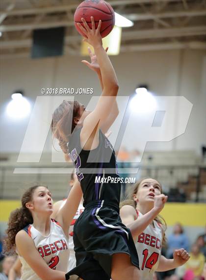 Thumbnail 3 in Beech vs Portland (TSSAA District 9-AAA Quarterfinal) photogallery.