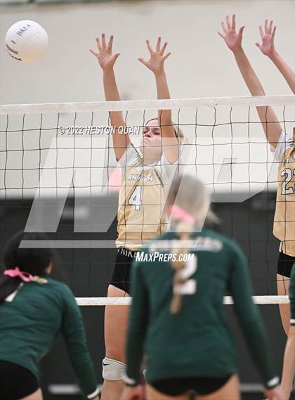 Thumbnail 3 in Canyon @ Brea Olinda photogallery.