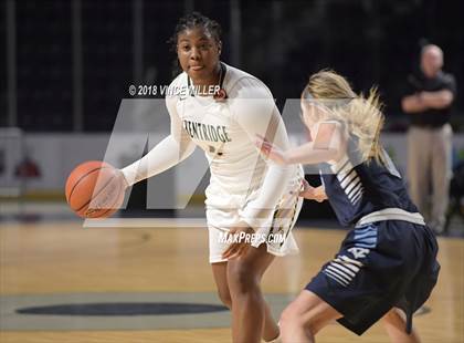 Thumbnail 1 in Kentridge vs. Central Valley photogallery.