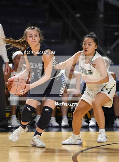 Thumbnail 1 in Kentridge vs. Central Valley photogallery.