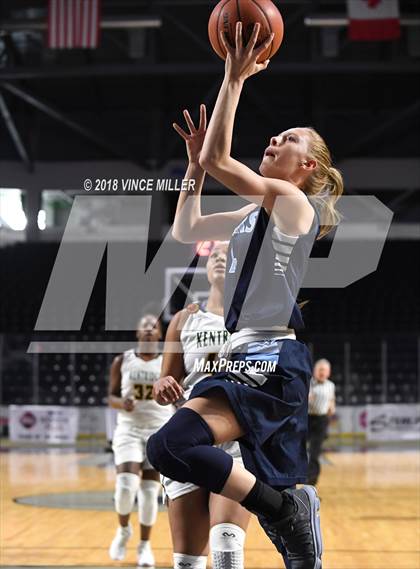 Thumbnail 2 in Kentridge vs. Central Valley photogallery.