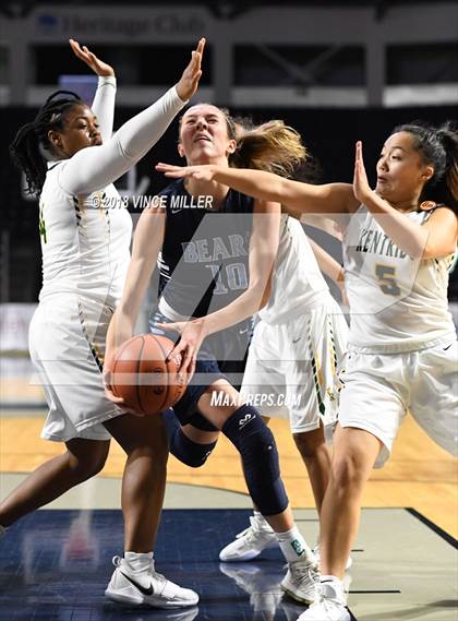 Thumbnail 1 in Kentridge vs. Central Valley photogallery.