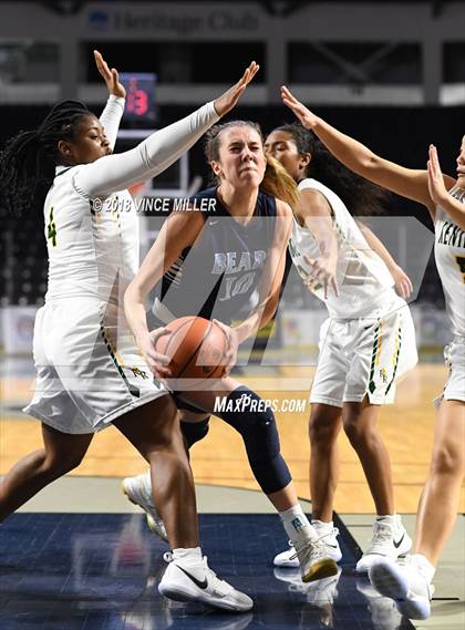 Thumbnail 3 in Kentridge vs. Central Valley photogallery.