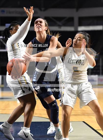 Thumbnail 2 in Kentridge vs. Central Valley photogallery.
