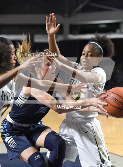 Thumbnail 3 in Kentridge vs. Central Valley photogallery.